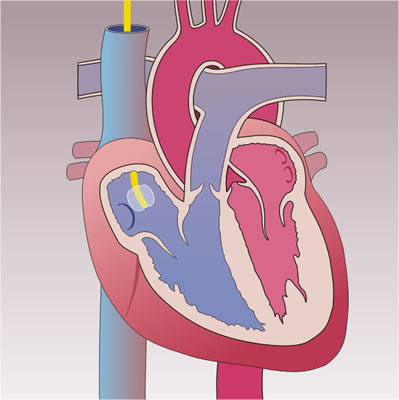 Galerie drawings-on-the-theme-of-anesthesia.