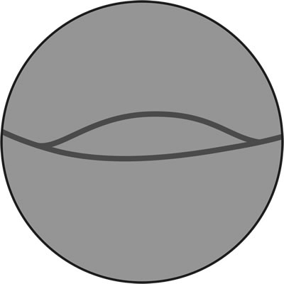 Galerie drawings-on-the-theme-of-anesthesia.