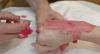 Med-Anesth: Galerie photographies-de-gestes-de-l-anesthn-siste-au-quotidien Photo 4