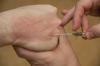 Med-Anesth: Galerie photographies-de-gestes-de-l-anesthn-siste-au-quotidien Photo 26