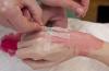 Med-Anesth: Galerie photographies-de-gestes-de-l-anesthn-siste-au-quotidien Photo 23